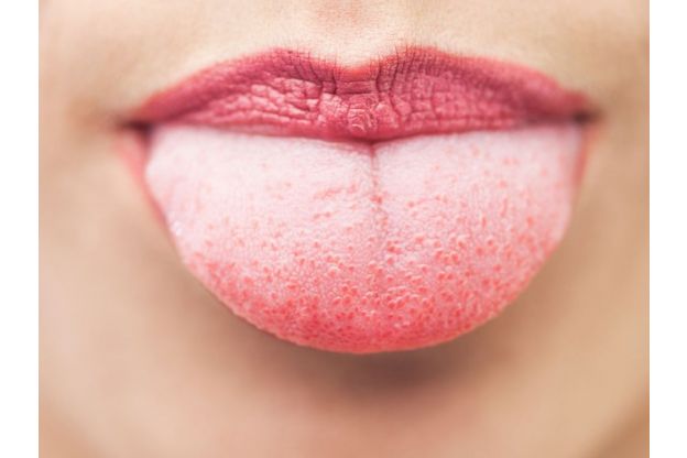 Hai la lingua bianca? Ecco cosa sta cercando di dirti il tuo corpo